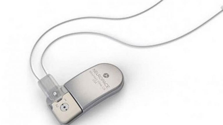 ابتكار جهاز يتنبأ بنوبات الصرع قبل أيام من حدوثها