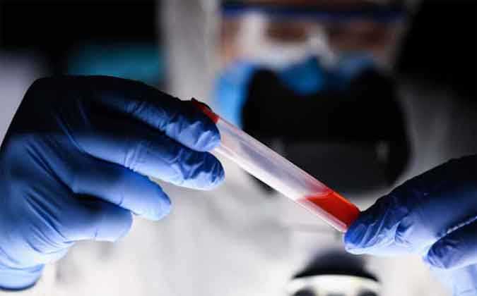 كورونا : 614 حالة اصابة جديدة بالفيروس