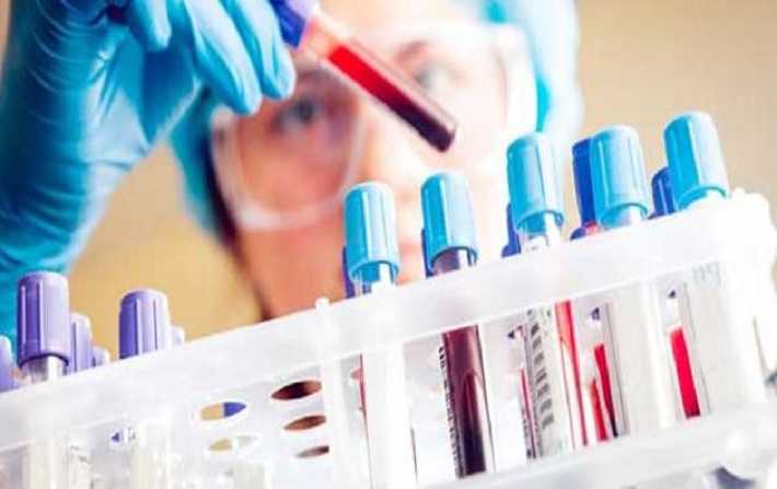 كورونا يوم 17 ديسمبر الجاري: تسجيل 133 حالة إصابة جديدة وأربعة وفيات